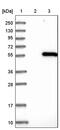 Inositol Hexakisphosphate Kinase 2 antibody, PA5-52449, Invitrogen Antibodies, Western Blot image 