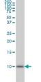 ubiquitin B antibody, H00007314-M01, Novus Biologicals, Western Blot image 