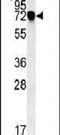 Neuron Derived Neurotrophic Factor antibody, PA5-25710, Invitrogen Antibodies, Western Blot image 