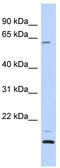 T-Complex 11 Like 2 antibody, TA329794, Origene, Western Blot image 