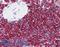 CD20 antibody, LS-B2605, Lifespan Biosciences, Immunohistochemistry paraffin image 