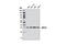 N(Alpha)-Acetyltransferase 10, NatA Catalytic Subunit antibody, 9046S, Cell Signaling Technology, Western Blot image 