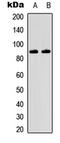 Inhibitor Of Nuclear Factor Kappa B Kinase Subunit Beta antibody, LS-C359031, Lifespan Biosciences, Western Blot image 