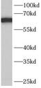 Adenylate Kinase 5 antibody, FNab00248, FineTest, Western Blot image 