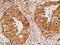 CD59 Molecule (CD59 Blood Group) antibody, CSB-PA778176, Cusabio, Immunohistochemistry paraffin image 