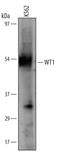 WT1 Transcription Factor antibody, AF5729, R&D Systems, Western Blot image 