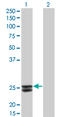 Prolactin antibody, LS-C198003, Lifespan Biosciences, Western Blot image 