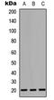 CD247 Molecule antibody, MBS8221871, MyBioSource, Western Blot image 