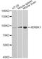 G Protein-Coupled Receptor Kinase 2 antibody, A1662, ABclonal Technology, Western Blot image 