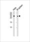 Transcription factor 21 antibody, MBS9207369, MyBioSource, Western Blot image 