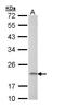 Adaptor Related Protein Complex 1 Subunit Sigma 2 antibody, TA308977, Origene, Western Blot image 