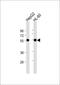 Interleukin 1 Receptor Type 1 antibody, 62-259, ProSci, Western Blot image 