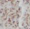 IL5 antibody, FNab10152, FineTest, Immunohistochemistry paraffin image 