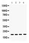 NME/NM23 Nucleoside Diphosphate Kinase 1 antibody, RP1090, Boster Biological Technology, Western Blot image 