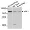 Natriuretic Peptide Receptor 3 antibody, PA5-76348, Invitrogen Antibodies, Western Blot image 