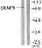 Sentrin-specific protease 5 antibody, LS-C118615, Lifespan Biosciences, Western Blot image 