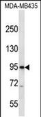 Cyclic Nucleotide Gated Channel Beta 3 antibody, PA5-48428, Invitrogen Antibodies, Western Blot image 