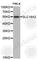 Solute Carrier Family 18 Member A2 antibody, A2799, ABclonal Technology, Western Blot image 