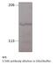 Olfactory guanylyl cyclase GC-D antibody, MBS540092, MyBioSource, Western Blot image 