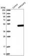 Phosphoribosyl Pyrophosphate Synthetase Associated Protein 2 antibody, PA5-54533, Invitrogen Antibodies, Western Blot image 