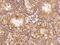 Adhesion G Protein-Coupled Receptor G2 antibody, 107977-T08, Sino Biological, Immunohistochemistry paraffin image 