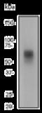 Matrix Metallopeptidase 14 antibody, ab51074, Abcam, Western Blot image 