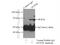 Decapping MRNA 1B antibody, 13863-1-AP, Proteintech Group, Immunoprecipitation image 