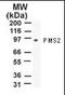 PMS1 Homolog 2, Mismatch Repair System Component antibody, orb87832, Biorbyt, Western Blot image 