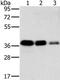 Mitochondrial Fission Regulator 1 antibody, PA5-50456, Invitrogen Antibodies, Western Blot image 