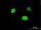 Iroquois Homeobox 5 antibody, H00010265-M06, Novus Biologicals, Immunocytochemistry image 