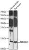 TPD52 Like 3 antibody, LS-C750514, Lifespan Biosciences, Western Blot image 