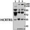 Hypocretin Receptor 1 antibody, A03066, Boster Biological Technology, Western Blot image 