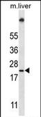 Ubiquitin Conjugating Enzyme E2 W antibody, PA5-71833, Invitrogen Antibodies, Western Blot image 