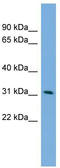 Protein Phosphatase, Mg2+/Mn2+ Dependent 1M antibody, TA340344, Origene, Western Blot image 