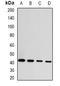 Ganglioside Induced Differentiation Associated Protein 1 antibody, orb341125, Biorbyt, Western Blot image 