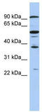 Enhancer Of Zeste 1 Polycomb Repressive Complex 2 Subunit antibody, TA335213, Origene, Western Blot image 