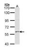 Ankyrin Repeat And SOCS Box Containing 2 antibody, PA5-29476, Invitrogen Antibodies, Western Blot image 