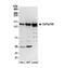 Chromatin Assembly Factor 1 Subunit A antibody, NB100-74609, Novus Biologicals, Western Blot image 
