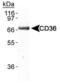 CD36 Molecule antibody, MA1-46000, Invitrogen Antibodies, Western Blot image 