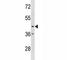 C-X3-C Motif Chemokine Receptor 1 antibody, F45247-0.4ML, NSJ Bioreagents, Western Blot image 