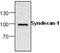 Syndecan 1 antibody, GTX59885, GeneTex, Western Blot image 