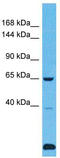 Ubiquitin Specific Peptidase 43 antibody, TA330816, Origene, Western Blot image 