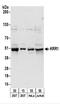 KRR1 Small Subunit Processome Component Homolog antibody, NBP2-22252, Novus Biologicals, Western Blot image 