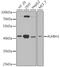 AlkB Homolog 1, Histone H2A Dioxygenase antibody, A6240, ABclonal Technology, Western Blot image 