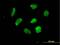 Zinc Finger Protein 302 antibody, H00055900-B01P, Novus Biologicals, Immunofluorescence image 