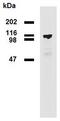 Phosphodiesterase 8A antibody, M05304, Boster Biological Technology, Western Blot image 