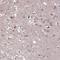 Calpain 12 antibody, NBP2-49079, Novus Biologicals, Immunohistochemistry paraffin image 