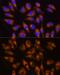 G Protein-Coupled Receptor Kinase 5 antibody, GTX64841, GeneTex, Immunofluorescence image 