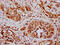 SWI/SNF Related, Matrix Associated, Actin Dependent Regulator Of Chromatin, Subfamily D, Member 2 antibody, CSB-PA846114LA01HU, Cusabio, Immunohistochemistry paraffin image 