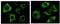 Keratin 5 antibody, MA5-15348, Invitrogen Antibodies, Immunofluorescence image 